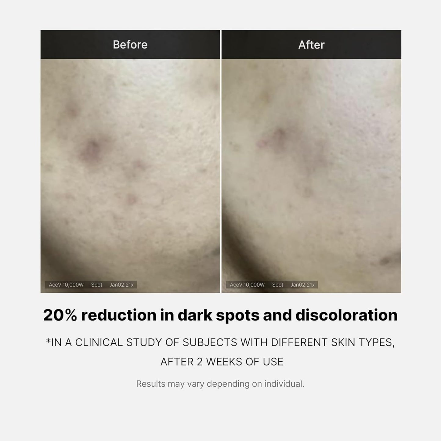 MEDICUBE Deep Vita C Serum 2.0, Pure Vitamin C for Radiance & Glow, Helps Improve the Look of Uneven Skin Tone, Korean Skincare (10 g × 3 Bottles)