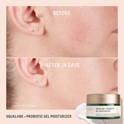 Biossance Squalane + Probiotic Balancing Face Gel Moisturizer - Advanced Formula for Oily & Acne-Prone Skin, Encapsulated Probiotics, Reduces Redness & Excess Oil, Soothes Sensitive Skin