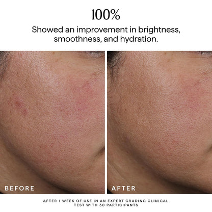 HERBIVORE Nova Bi-Phase Facial Oil, Hydrating, Boosts Radiance Bi-phase face oil with fermented niacinamide, turmeric & squalane. Hydrates, boosts glow and helps even tone