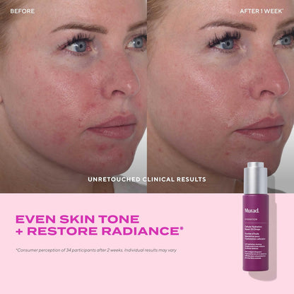 Murad Cellular Hydration Repair Oil Drops - Multi-Vitamin Blend, Hydrating multi-vitamin face oil with Bilberry Seed Oil strengthens the skin barrier and relieves redness for glowy skin