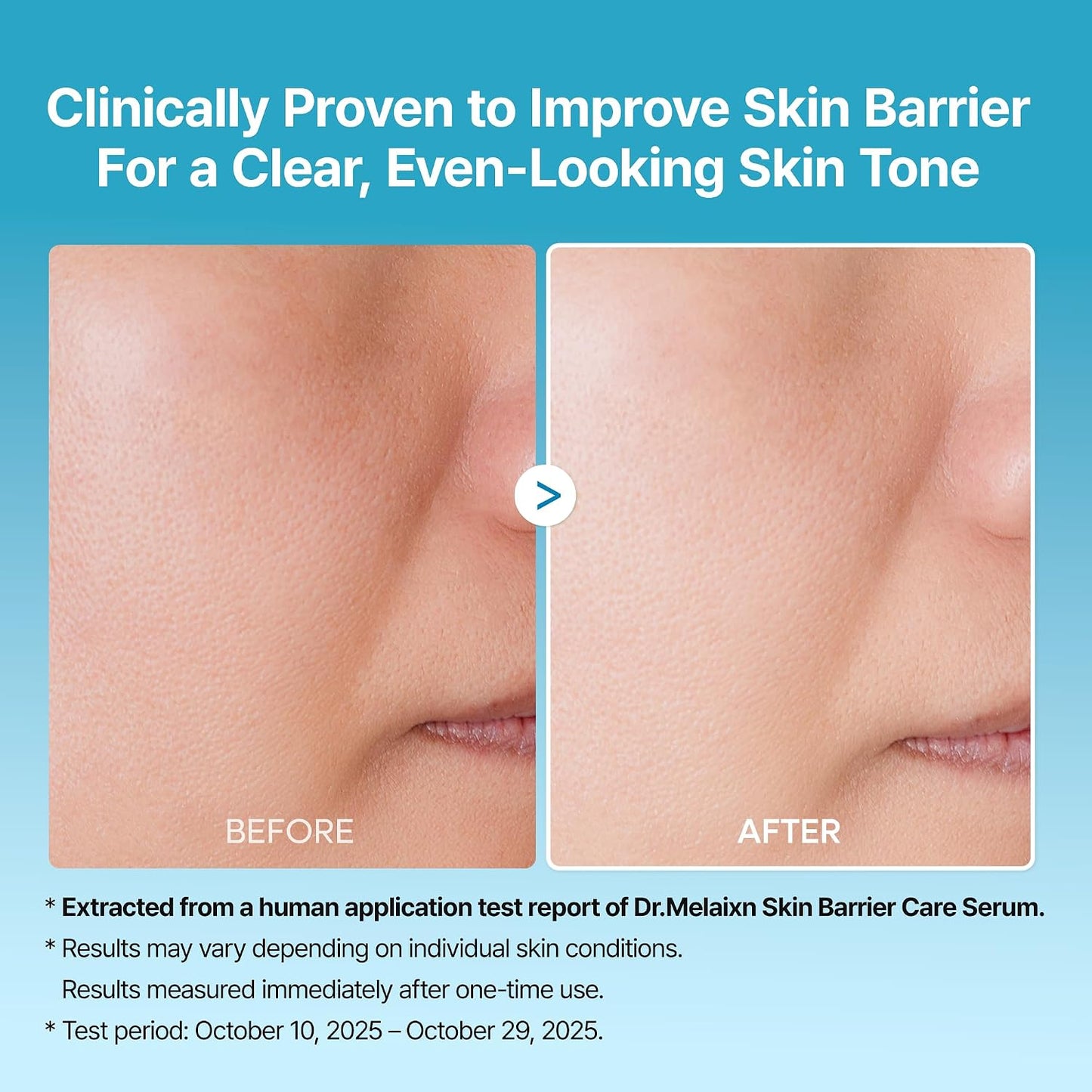 Dr.Melaxin Peel Shot Exfoliating TX Serum – 99% Pure Tranexamic Acid & Niacinamide + AHA PHA Brightening Exfoliating for Uneven Skin Tone, Dark Spots & Dullness, Smooth, Korean Skincare