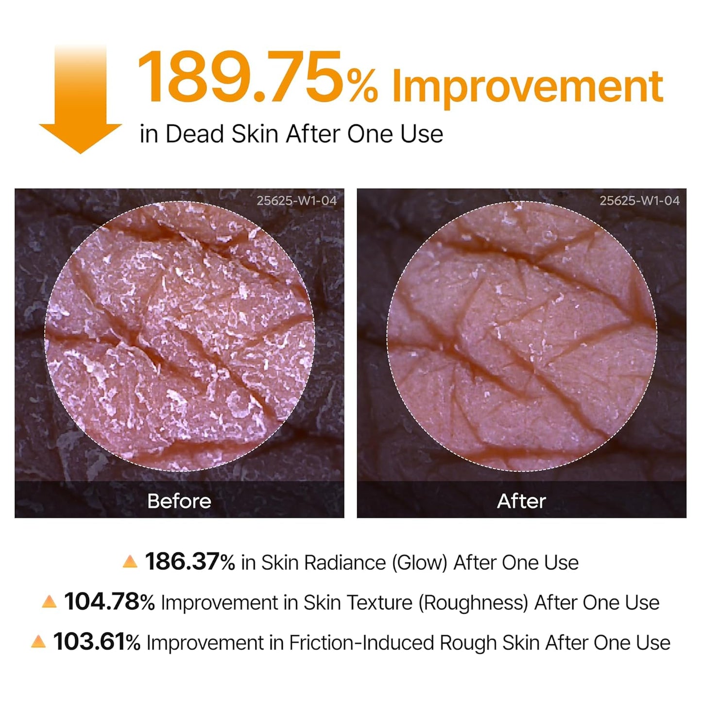 Dr.Melaxin Peel Shot Kojic Acid Turmeric Body Exfoliator Spray 6.76 fl.oz - AHA PHA Niacinamide Body Scrub for KP Bumps, Dark Spots, Uneven Skin Tone, Dead Skin, Korean Skin Care