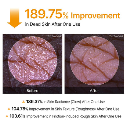 Dr.Melaxin Peel Shot Kojic Acid Turmeric Body Exfoliator Spray 6.76 fl.oz - AHA PHA Niacinamide Body Scrub for KP Bumps, Dark Spots, Uneven Skin Tone, Dead Skin, Korean Skin Care