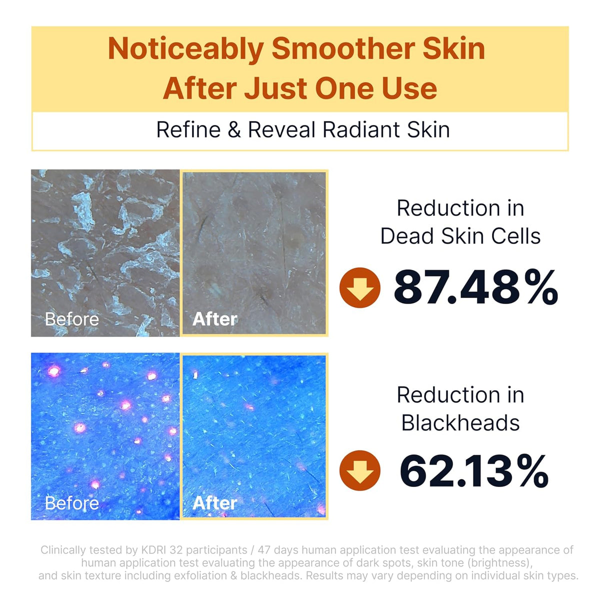 SUNGBOON EDITOR Kojic Acid Peel Shot Serum, Dark Spot Care