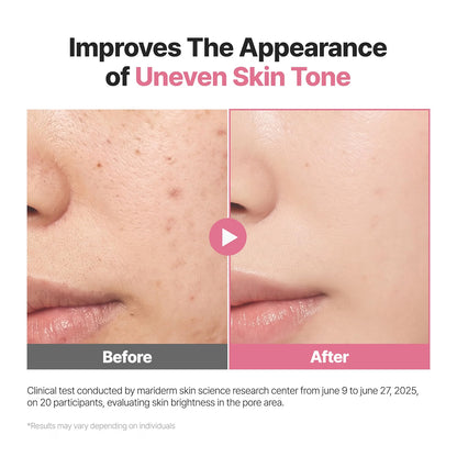 P.CALM Red Rice Bubble Deep Mask