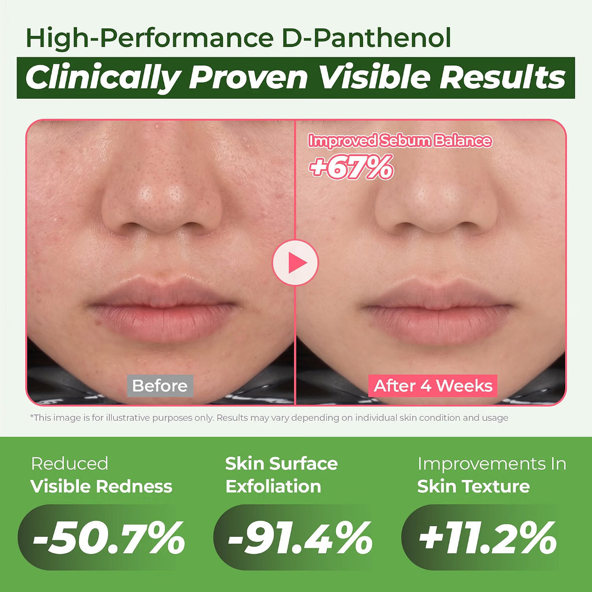 JUMISO D-Panthenol Hydrating Serum, 10 HA for Sensitive Skin