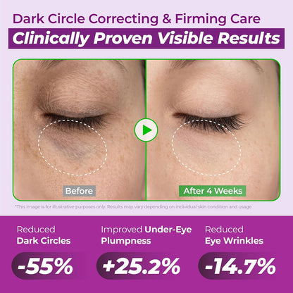 JUMISO Niacinamide Eye Cream for Dark Circles, Caffeine & Peptide