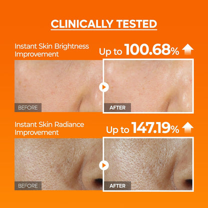 Dr.Melaxin Peel Shot Glow Rice Peeling Ampoule, Dead Skin Gentle Exfoliating Ampoule with Rice Water Extract, AHA BHA, Niacinamide, Daily Skin Texture Care, Korean Skincare