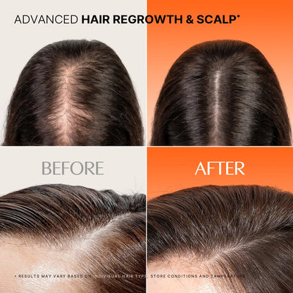 lilyeve GROWTURN Exosome Spicule Ampoule 3000, for Hair Growth