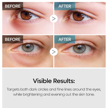 DR.MELAXIN TX Tranexamic Acid Retinalsome Dual Eye Cream with Adenosine Niacinamide for Dark circle Repairing, Daily Anti-Aging Under Eye Care