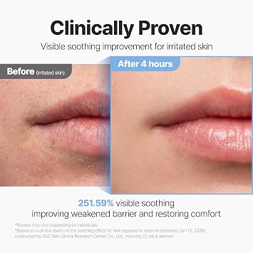 P.CALM Active PDRN 50000 Rejuvenating Cream, 20g / 0.7 oz Hydrating Moisturizer, Niacinamide, Panthenol, Skin Renewal, Plump Glow