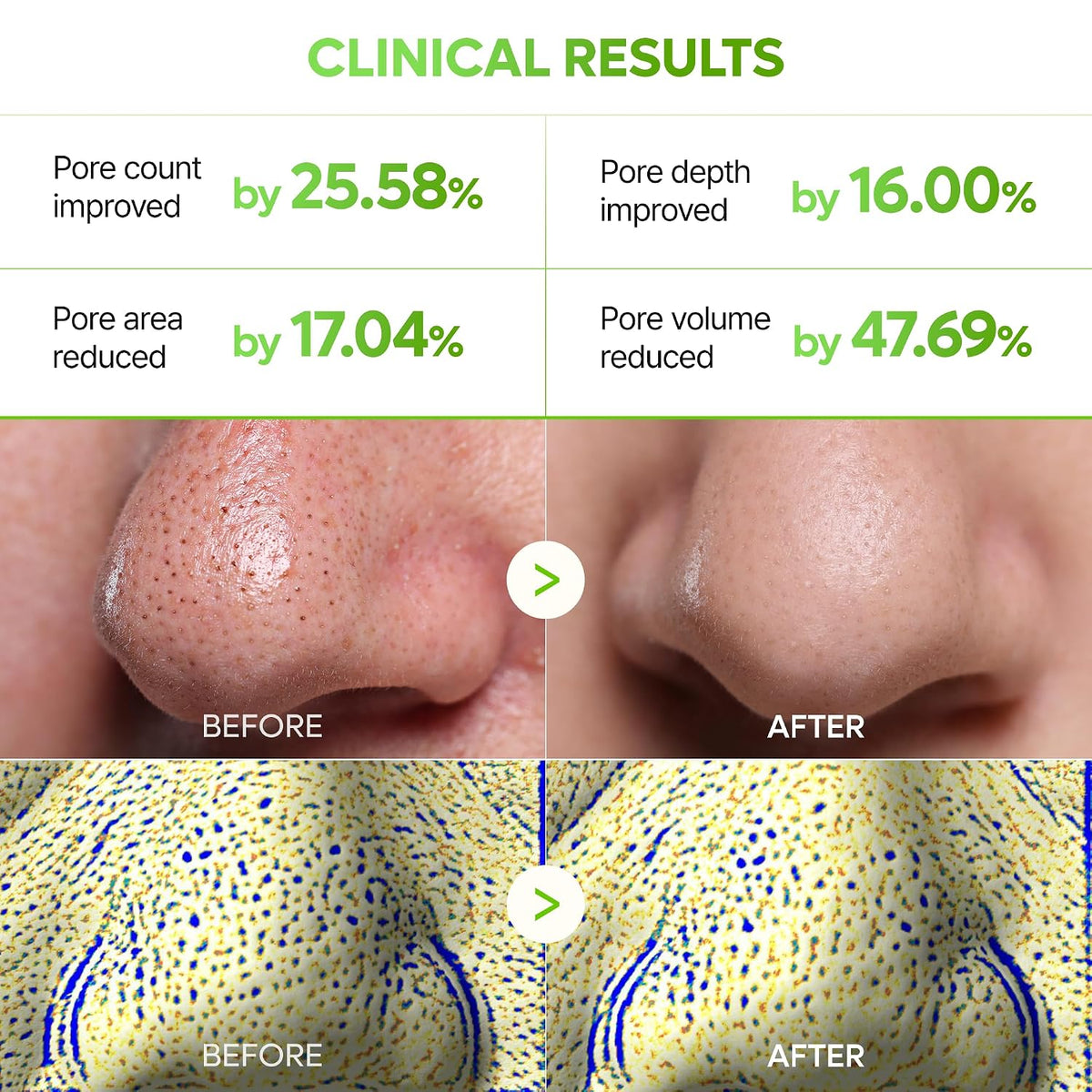Dr.Melaxin CACTOX 3-STEP NOSE MASK (1 each) with AHA & PHA for Sebum Softening Pore Tightening Skin Repair 3-Step Nose Pore mask