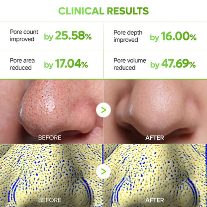 Dr.Melaxin CACTOX 3-STEP NOSE MASK (1 each) with AHA & PHA for Sebum Softening Pore Tightening Skin Repair 3-Step Nose Pore mask