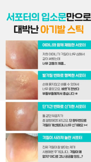 SUNGBOON EDITOR - LHA Baby Foot Scrub Stick