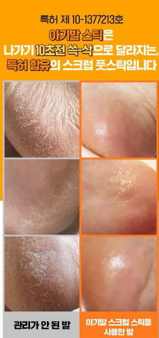 SUNGBOON EDITOR - LHA Baby Foot Scrub Stick