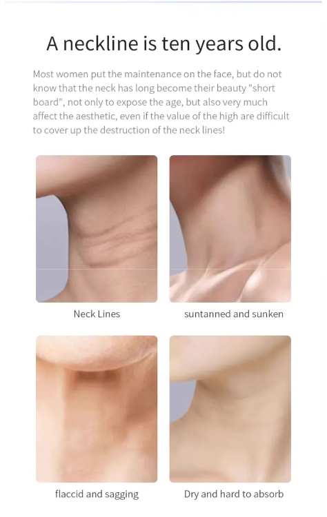 Beautyronics - USB Rechargeable Neck Light Therapy Device