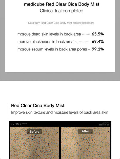 medicube - Red Clear Cica Body Mist