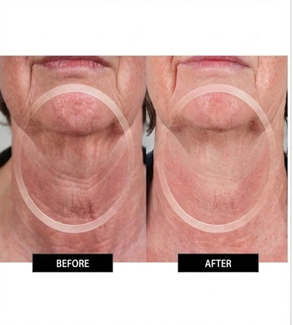 Numiere EMS Neck & Face Lift