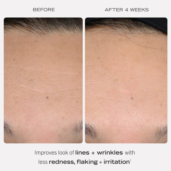 First Aid Beauty 0.3% Retinol Complex Serum with Peptides