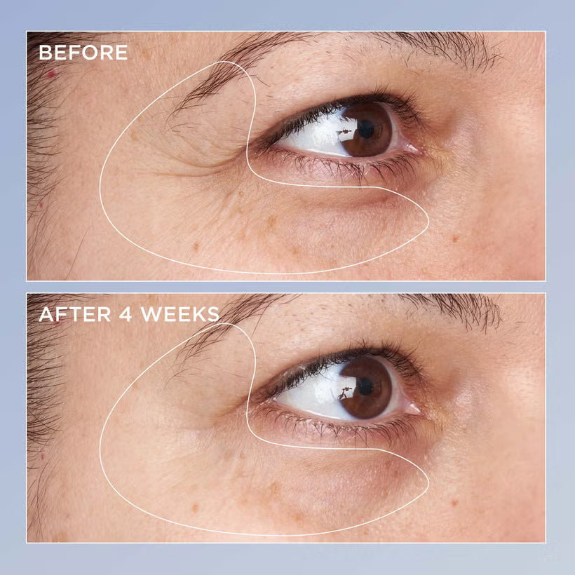 Perricone Md High Potency Triple Retinol Renewal Eye Serum