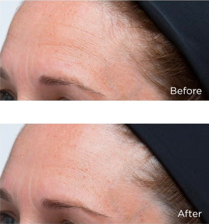 Perricone MD High Potency Classics Hyaluronic Intensive Moisturizer - Smooths the skin's surface to minimize the appearance of wrinkles, 3 Types of Hyaluronic Acid