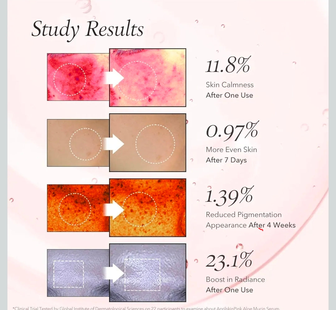 Suero de mucina de aloe rosa APRILSKIN: fórmula hidratante con 78 % de mucina de aloe de Jeju y acabado no pegajoso para una apariencia radiante.