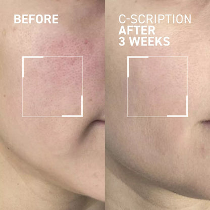 Dr. Brandt Bright This Way C Scription Brightening Serum - Fades dark spots, improves the look of fine lines and wrinkles, helps boost collagen production for firmer-looking skin