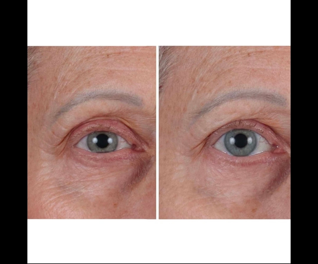 Perricone MD Cold Plasma Plus+ The Essence - Fast Absorbing & Intensely Hydrating Lightweight Treatment - Leaves skin smooth, plump & revitalized, Improves loss of radiance, uneven texture & tone