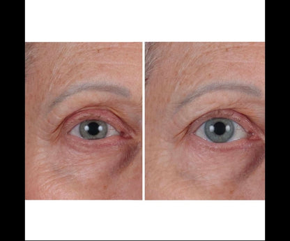 Perricone MD Cold Plasma Plus+ The Essence - Fast Absorbing & Intensely Hydrating Lightweight Treatment - Leaves skin smooth, plump & revitalized, Improves loss of radiance, uneven texture & tone