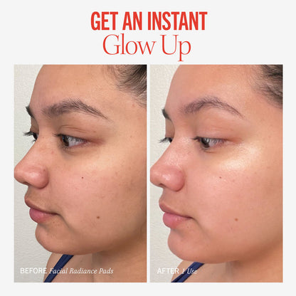 Discos faciales radiantes First Aid Beauty con ácidos glicólico y láctico