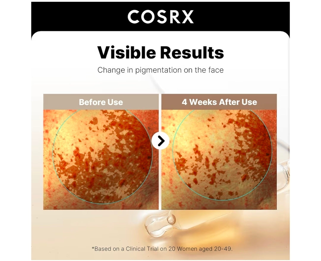 COSRX The Alpha Arbutin 2 Discoloration Care Serum - Even skin tone while soothing irritation and enhancing brightness, reduce dark spots and hyperpigmentation - Tranexamic Acid ( TXA) and Niacinamide