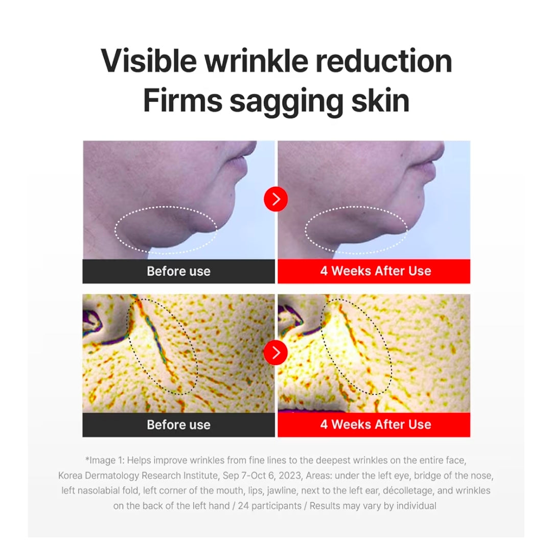 CENTELLIAN 24 Madeca Cream Time Reverse: la crema antienvejecimiento avanzada está diseñada para combatir 10 signos de problemas de la piel, como líneas finas, arrugas, firmeza, tono de piel desigual y opacidad.