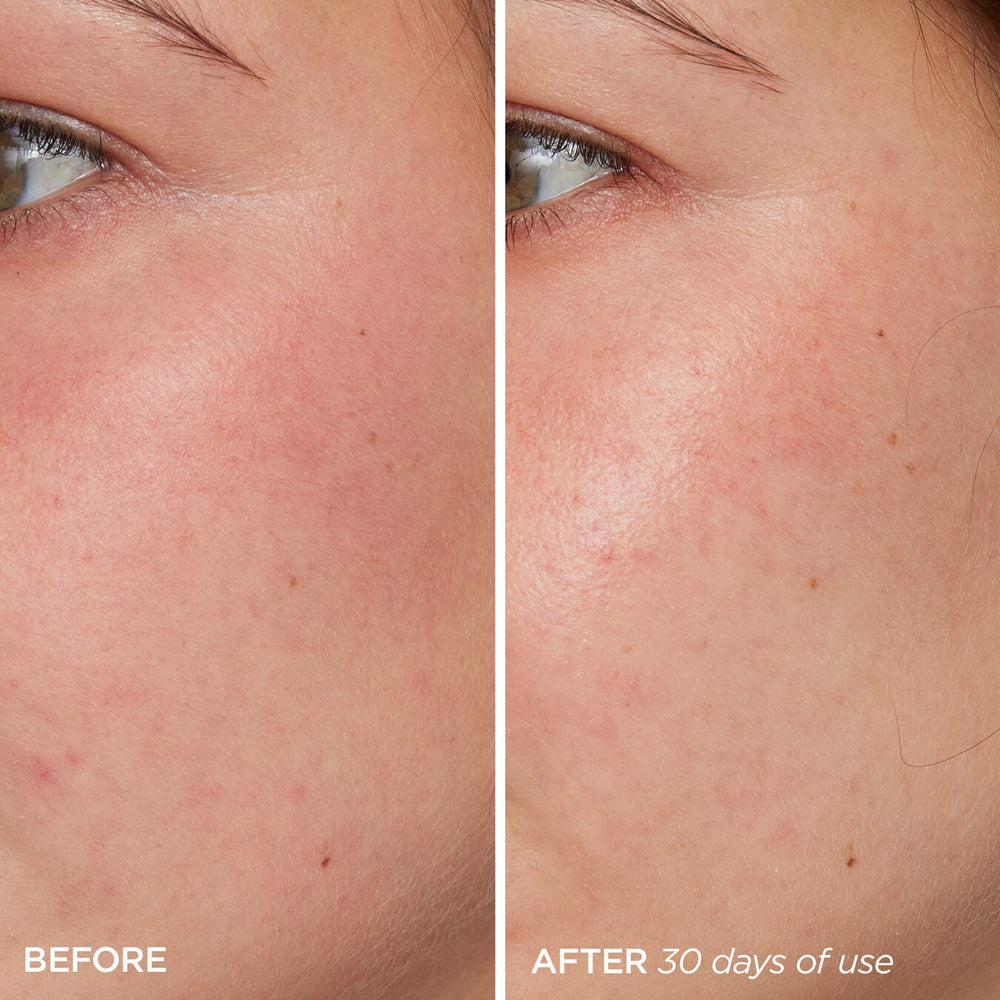 BeautyBio The Daily - Tono desigual, opacidad, deshidratación, estrés ambiental, piel sensible