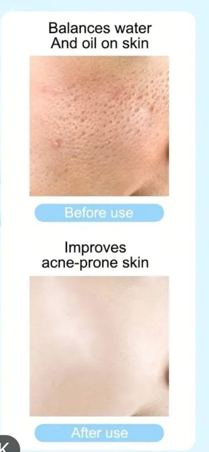 Dispositivo facial 7 en 1 con radiofrecuencia (RF) LED y electroestimulación muscular (EMS), herramienta multifuncional para limpieza profunda, antienvejecimiento y rejuvenecimiento de la piel, color blanco.