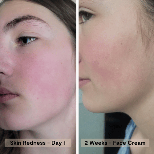 Crema facial hidratante recuperadora Blossom Essentials