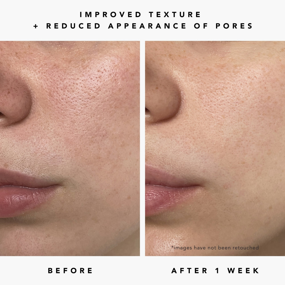 Herbivore Milky Way 10% AHA + Oat Soothing Exfoliating Serum - Deeply exfoliates the surface of skin for instant glow and repairs the skin barrier