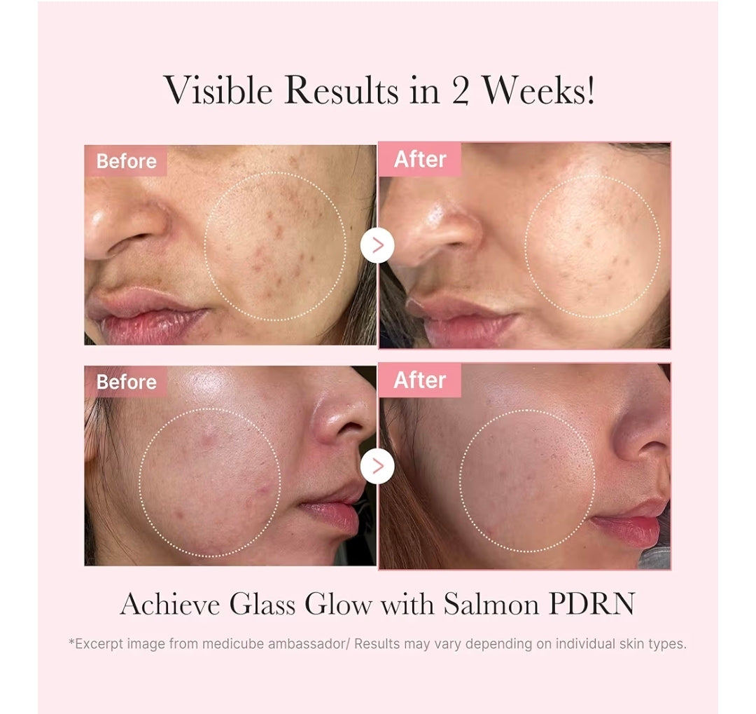Kit de prueba Salmon DNA PDRN de medicube - Mini set de cuidado de la piel Glass Glow con tónico, suero y mascarilla hidratante, reafirmante y humectante.