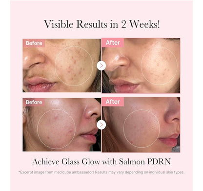 Kit de prueba Salmon DNA PDRN de medicube - Mini set de cuidado de la piel Glass Glow con tónico, suero y mascarilla hidratante, reafirmante y humectante.