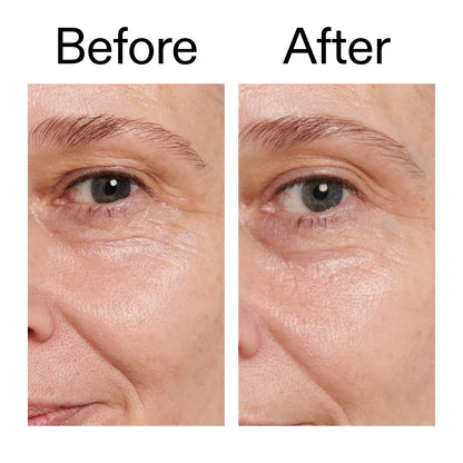 Crema para ojos con retinol INKEY: formulada para reducir las líneas finas y arrugas con retinol suave de liberación lenta.