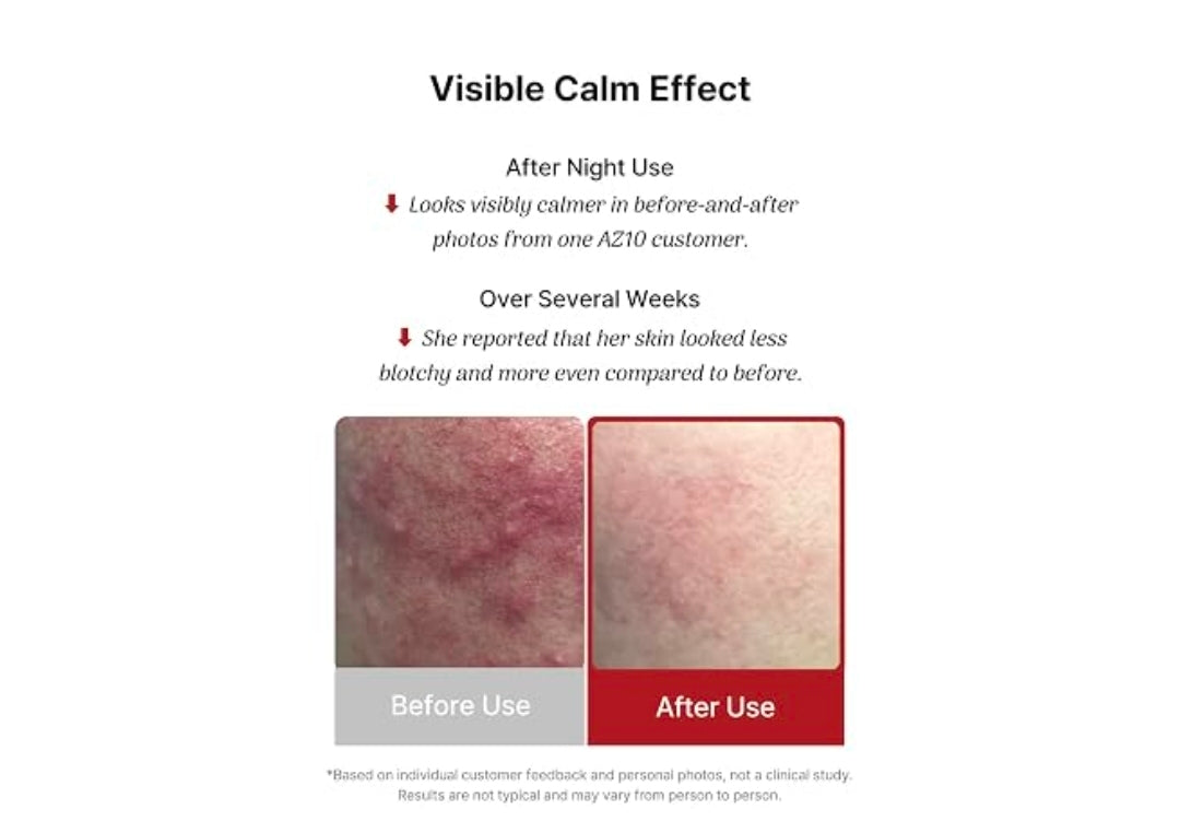 Cos De BAHA Premium Azelaic Acid 10% Serum 1 Fl Oz – Niacinamide & Panthenol Face Serum for Blemish-Prone, Redness-Prone & Oily Skin – Lightweight Aloe-Based Korean Skincare