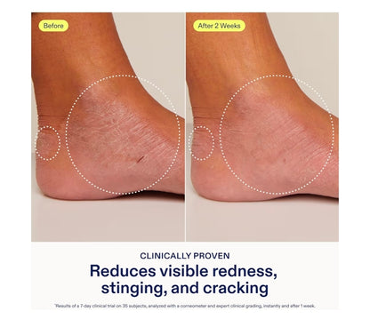 Crema para el alivio de manos Skinfix: reduce el enrojecimiento visible, el escozor y las grietas en pieles secas y sensibles. Aprobada por la Asociación Nacional del Eczema. Sin fragancia. Vegana y sin crueldad animal.