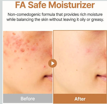 PURITO Oat In Calming Gel Cream - 77% Oat Seed Water Lightweight Water-Gel Face Moisturizer, Non-Comedogenic, Fragrance-Free, Sensitive & Blemish-Prone Skin