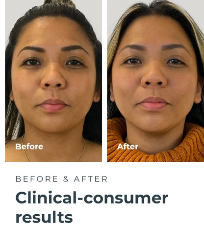 Foreo UFO 2 - Swedish Beauty Tech Power Mask - Supercharged LED Cooling/Warming 1 min Face Treatment - Microcurrent Face Moisturizer - Dark Spot & Acne Scar Treatment for Face - Anti Aging – Nourishing - Pearl Pink