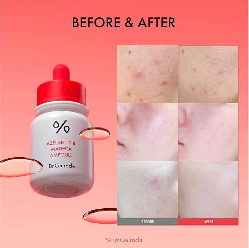 Dr.Ceuracle Azelaic Acid 10 & Madecassoside Ampoule - Redness Relief and Soothing Serum for Sensitive Skin