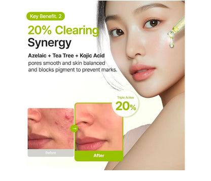 Suero facial PURITO con ácido azelaico al 10 % + ácido kójico + árbol de té: para acné, marcas y brotes, con alto contenido de ácido azelaico.