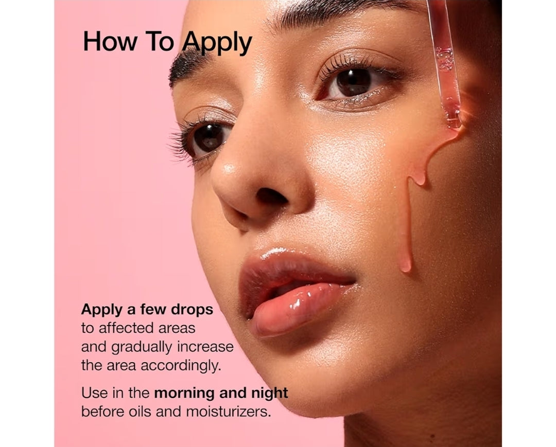 ANUA Niacinamide 10 + TXA 4 Serum, Hyaluronic Acid, Tranexamic Acid, Facial Serum for Glass Skin, Clarifying, Radiant Complexion with Natural Color