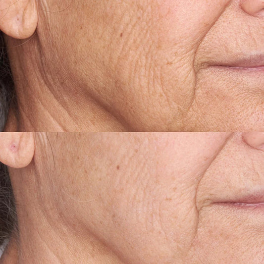 Perricone MD Hidratante reafirmante y de acabado de alta potencia con FPS 30 de amplio espectro