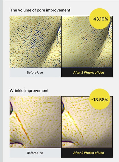 Celimax The Vita A Retinol Shot Tightening Serum - with Pure Vitamin A Retinol, Peptide, Pore Minimizer, Wrinkles & Fine Lines, Firmer Skin, Anti-Aging, Skin Smoothing