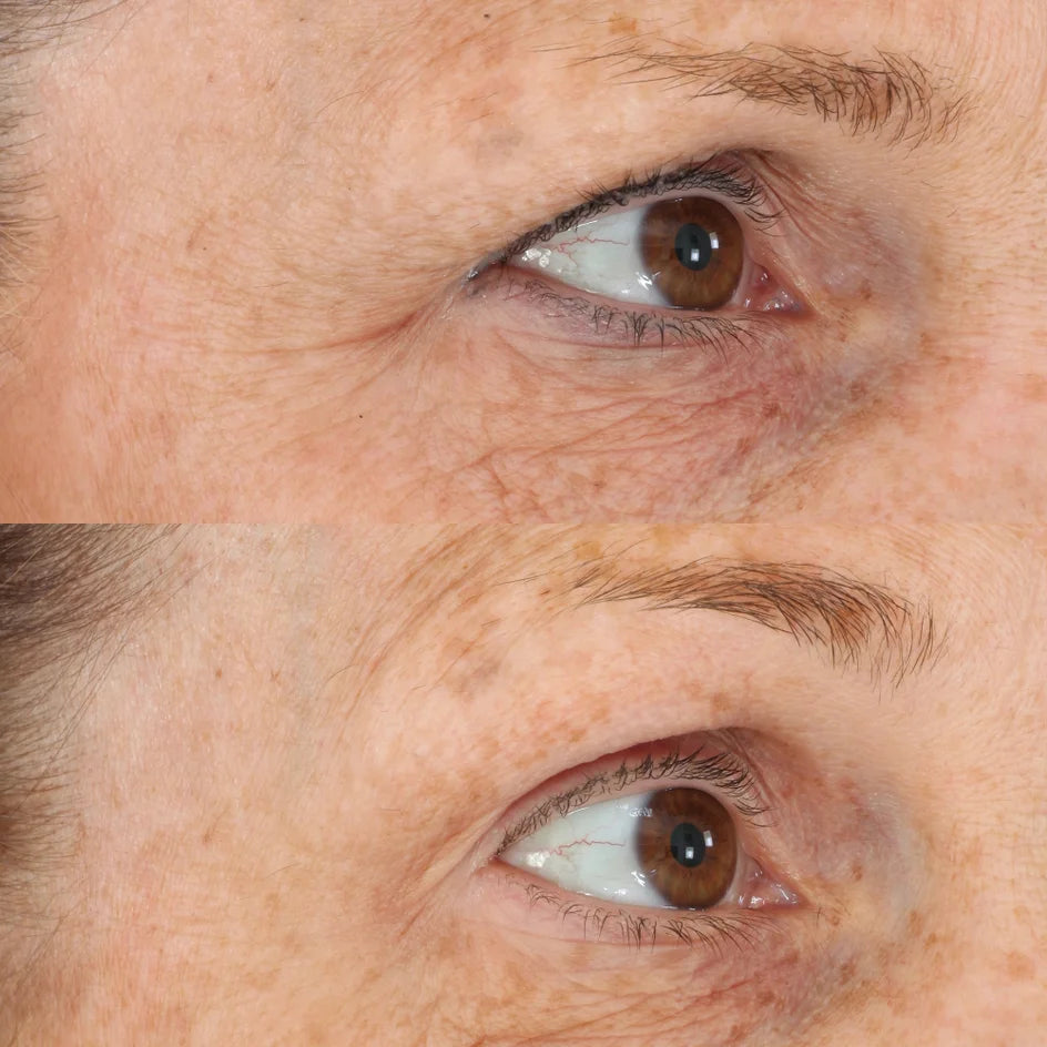 Perricone MD Essential Fx Acyl Glutathione Eyelid Lift Serum: suero ultraligero para corregir la apariencia de arrugas, piel crecida y caída.
