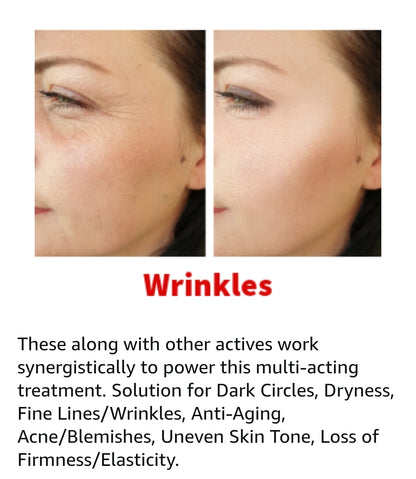 First Aid Beauty 5-IN-1 Eye Cream - Smooth, brighten, hydrate, correct and protect